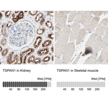 Anti-TSPAN1 antibody produced in rabbit Prestige Antibodies&#174; Powered by Atlas Antibodies, affinity isolated antibody, buffered aqueous glycerol solution