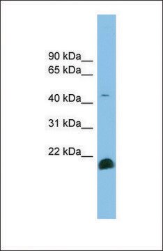 Anti-TGFB2 antibody produced in rabbit affinity isolated antibody