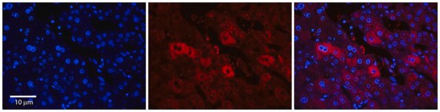 Anti-EEA1 antibody produced in rabbit affinity isolated antibody