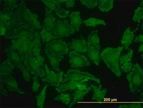 Monoclonal Anti-KRAS antibody produced in mouse clone 3B10-2F2, purified immunoglobulin, buffered aqueous solution