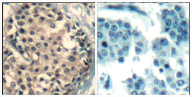 Anti-phospho-HDAC9/HDAC4/HDAC5 (pSer246/pSer259/pSer220) antibody produced in rabbit affinity isolated antibody