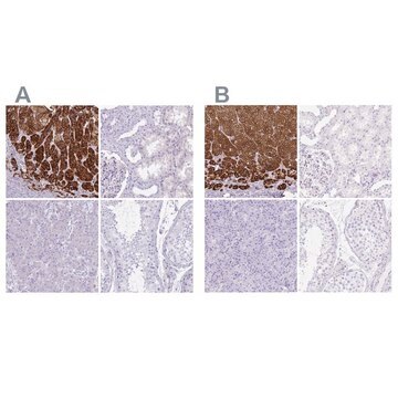 Anti-CYP21A2 antibody produced in rabbit Prestige Antibodies&#174; Powered by Atlas Antibodies, affinity isolated antibody, buffered aqueous glycerol solution