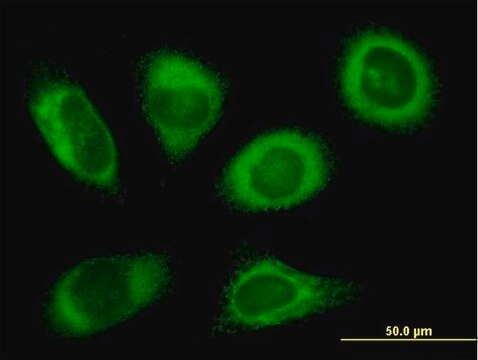 Anti-RPN2 antibody produced in mouse purified immunoglobulin, buffered aqueous solution