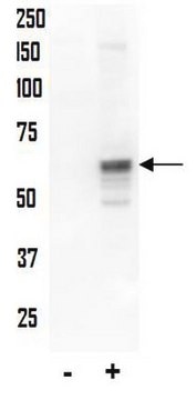 Anti-phospho-AKT (Thr34) Antibody Upstate&#174;, from rabbit