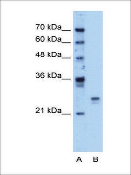 Anti-HMGB1 (AB2) antibody produced in rabbit IgG fraction of antiserum