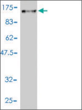 Monoclonal Anti-DNAI1 antibody produced in mouse clone 2D10-2A5, purified immunoglobulin, buffered aqueous solution