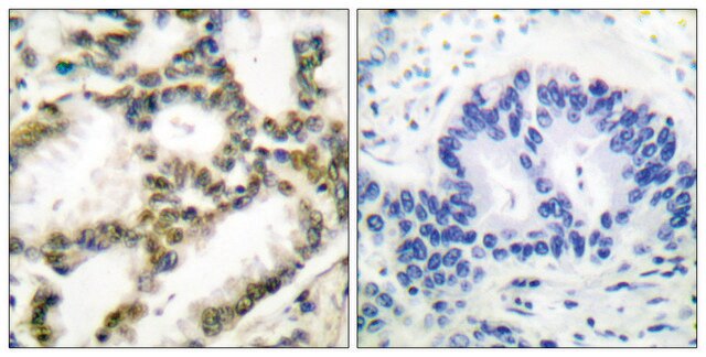 Anti-DJ-1 antibody produced in rabbit affinity isolated antibody