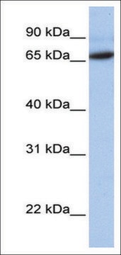 Anti-FOXO1 (AB2) antibody produced in rabbit affinity isolated antibody