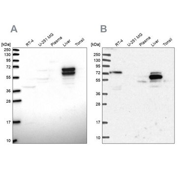 Anti-ACSS3 antibody produced in rabbit Prestige Antibodies&#174; Powered by Atlas Antibodies, affinity isolated antibody, buffered aqueous glycerol solution