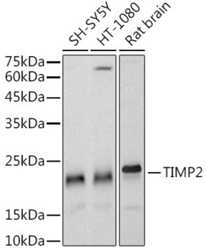 Anti-TIMP2 Antibody, clone 8R5Q2, Rabbit Monoclonal