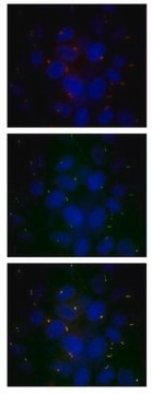 Anti-IFT88 Antibody serum, from rabbit