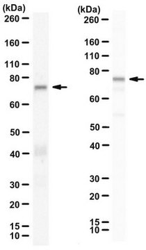 Ant-Zyxin Anti-Zyxin Antibody, Cat. No. ABC1463 is a rabbit polyclonal antibody that detects Zyxin and has been tested for use in Immunocytochemistry and Western Blotting.