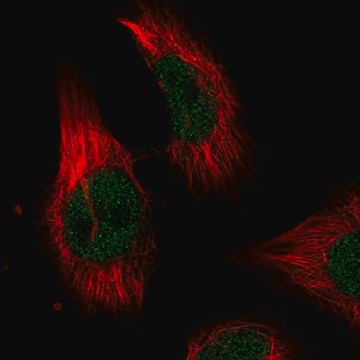 Anti-ILKAP antibody produced in rabbit Prestige Antibodies&#174; Powered by Atlas Antibodies, affinity isolated antibody, buffered aqueous glycerol solution