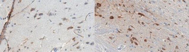 Anti-Serotonin Receptor 1B Antibody, clone 1C2.1 clone 1C2.1, from mouse