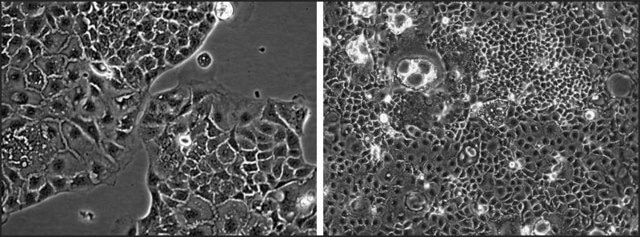 MDR1/BCRP Double Knockout Caco-2 Cells one vial