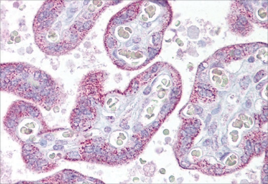 Anti-TRPC4 antibody produced in rabbit affinity isolated antibody