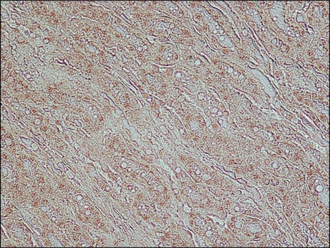 Anti-TDP-43 (C-terminal) antibody produced in rabbit ~1.0&#160;mg/mL, affinity isolated antibody, buffered aqueous solution