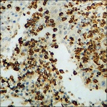 Anti-phospho-p62 Dok (pTyr398) antibody produced in rabbit affinity isolated antibody