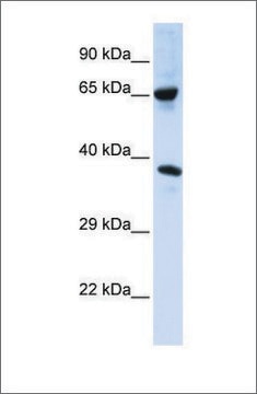 Anti-C6ORF134 antibody produced in rabbit affinity isolated antibody