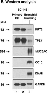 Anti-DNAI1 antibody produced in rabbit Prestige Antibodies&#174; Powered by Atlas Antibodies, affinity isolated antibody, buffered aqueous glycerol solution, Ab1