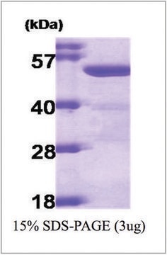 ALDH2 human recombinant, expressed in E. coli, &#8805;90% (SDS-PAGE)