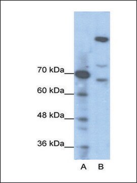 Anti-GLI1 (AB2) antibody produced in rabbit IgG fraction of antiserum