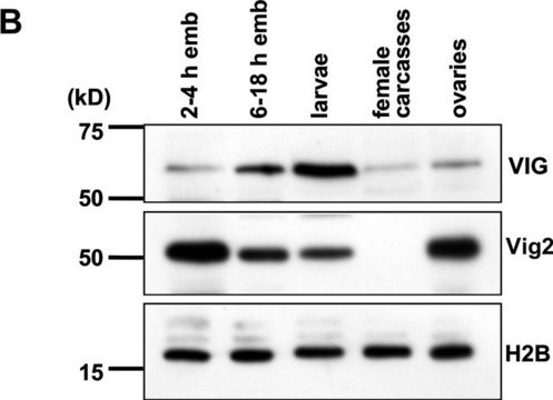 Anti-Histone H2B Antibody Upstate&#174;, from rabbit