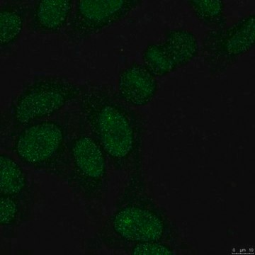 Anti-SUMO-2/3 Antibody, clone 8A2 clone 8A2, from mouse