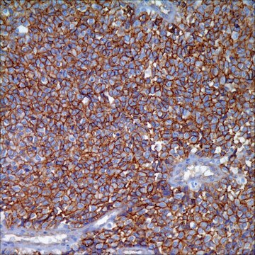 CD99 (EPR3097Y) Rabbit Monoclonal Primary Antibody