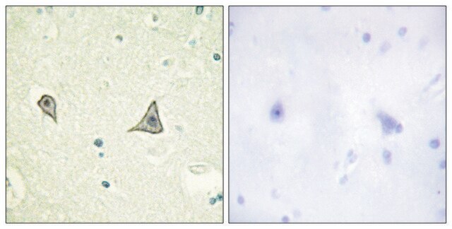 Anti-M-CSF Receptor antibody produced in rabbit affinity isolated antibody