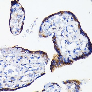 Anti-Bad antibody produced in rabbit