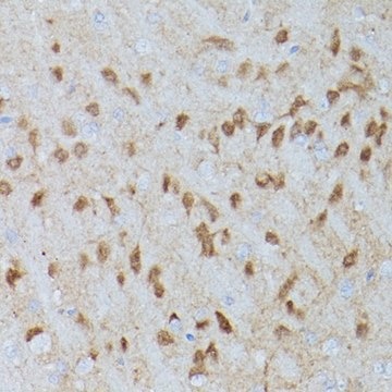 Anti-Phospho-Erk1-T202/Y204 + Erk2-T185/Y187 antibody produced in rabbit