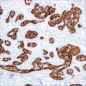 Cytokeratin 5 (EP1601Y) + Cytokeratin 14 (LL002) Mouse and Rabbit MonoclonalAntibody