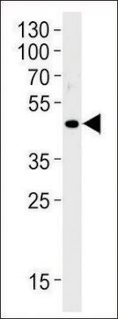 ANTI-OR51E1(C-TERMINAL) antibody produced in rabbit affinity isolated antibody, buffered aqueous solution