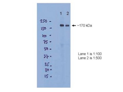 Anti-NMDAR2B Antibody, CT ascites fluid, clone 1C6.5C4, Chemicon&#174;