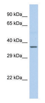 Anti-CYTB (C-terminal) antibody produced in rabbit affinity isolated antibody