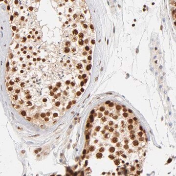 Anti-ILKAP antibody produced in rabbit Prestige Antibodies&#174; Powered by Atlas Antibodies, affinity isolated antibody, buffered aqueous glycerol solution