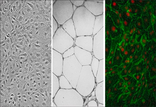 Human Dermal Microvascular Endothelial Cells: CADMEC/HMVEC, adult