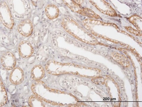 Monoclonal Anti-CTSK antibody produced in mouse clone 2F1, purified immunoglobulin, buffered aqueous solution