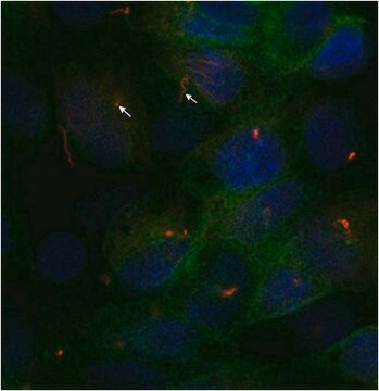 Anti-acetyl-alpha tubulin Antibody, clone 6-11B-1 clone 6-11B-1, from mouse