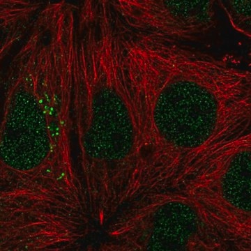 Anti-ST14 antibody produced in rabbit Prestige Antibodies&#174; Powered by Atlas Antibodies, affinity isolated antibody