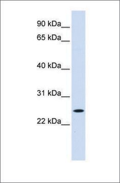 Anti-NOL3 antibody produced in rabbit affinity isolated antibody