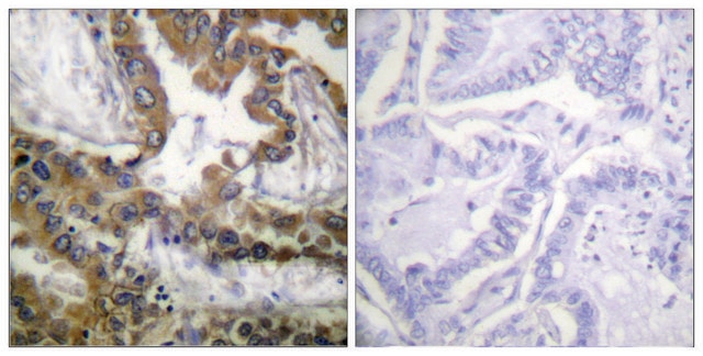 Anti-VEGFR2 antibody produced in rabbit affinity isolated antibody