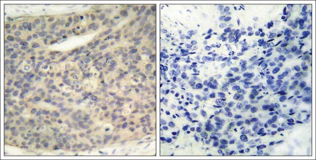 Anti-phospho-LIMK1 (pThr508) antibody produced in rabbit affinity isolated antibody