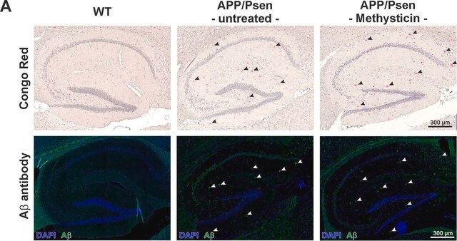 Anti-Beta-Amyloid 1-42 Antibody Chemicon&#174;, from rabbit