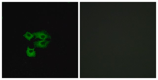 Anti-LY6E antibody produced in rabbit affinity isolated antibody