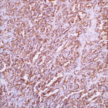 CD31 (EP78) Rabbit Monoclonal Primary Antibody