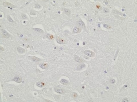 Anti-C9ORF72/C9RANT (poly-GR) Antibody, clone 5A2 clone 5A2, 1&#160;mg/mL, from rat