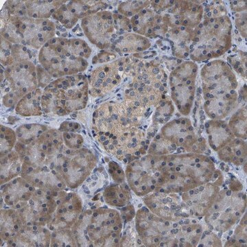 Anti-DSE antibody produced in rabbit Prestige Antibodies&#174; Powered by Atlas Antibodies, affinity isolated antibody, buffered aqueous glycerol solution