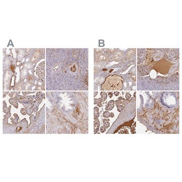 Anti-ALB antibody produced in rabbit Prestige Antibodies&#174; Powered by Atlas Antibodies, affinity isolated antibody, buffered aqueous glycerol solution